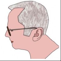 Robert van der Meij de Bie